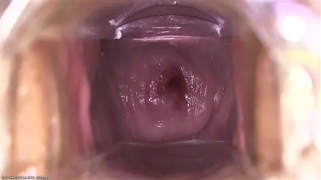 Чешская модель крупно показывает киску раскрытую гинекологическим прибором